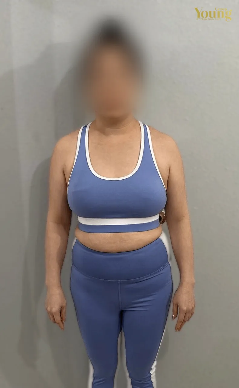Chị Hong Phan trước và sau khi giảm 20 pound (đã che mặt), ảnh trước