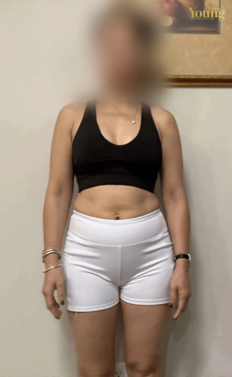 Chị Melina Pham trước và sau khi giảm 17 pound (đã che mặt), ảnh trước