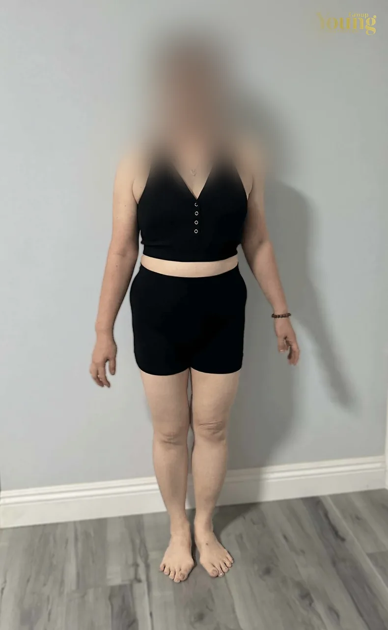 Chị Nhi Nguyen trước và sau khi giảm 36.4 pound (đã che mặt), ảnh sau
